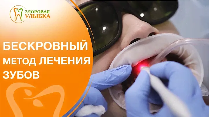 Лечение зубов лазером видео. 🌟 Самый современный способ лечения зубов с помощью лазера. 12+