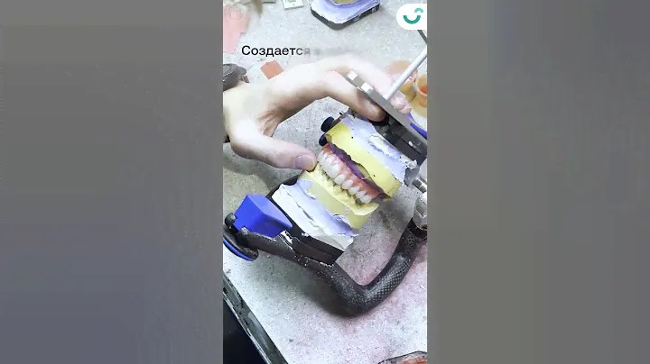 Зубы из воска?! Зачем нужны при создании протезов на импланты